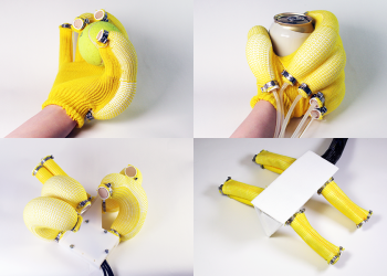 Can Bionic Limbs Achieve Human-Level Dexterity?