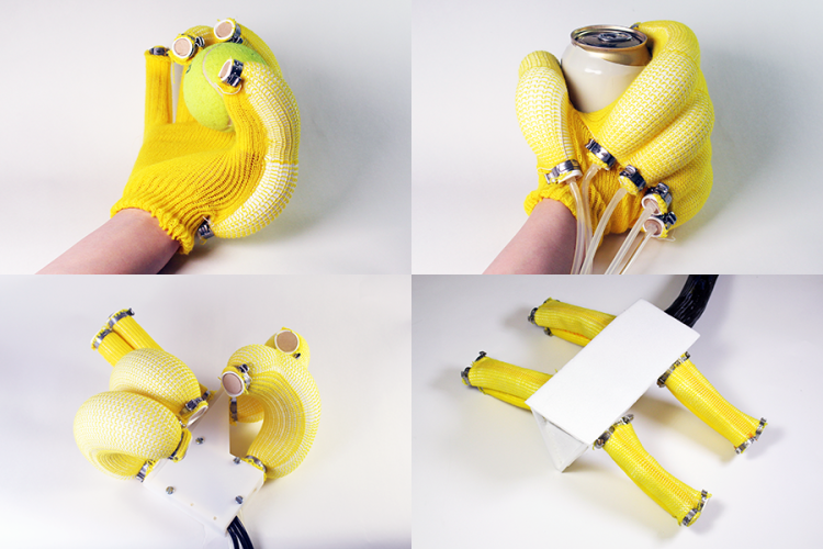Can Bionic Limbs Achieve Human-Level Dexterity?