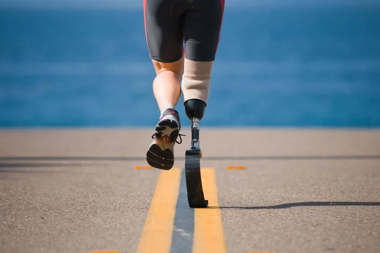 How Would Bionics Change Human Perception of Disability?
