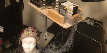 Bionic Enhancements: Could They Improve Our Cognitive Abilities?