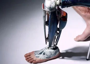 The Future of Prosthetics: Is It Fully Bionic?