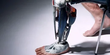 The Future of Prosthetics: Is It Fully Bionic?