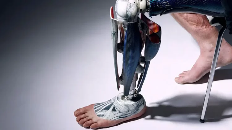 The Future of Prosthetics: Is It Fully Bionic?